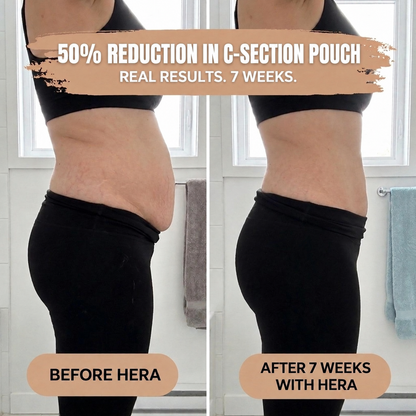 Postpartum Panties - 360° Compression