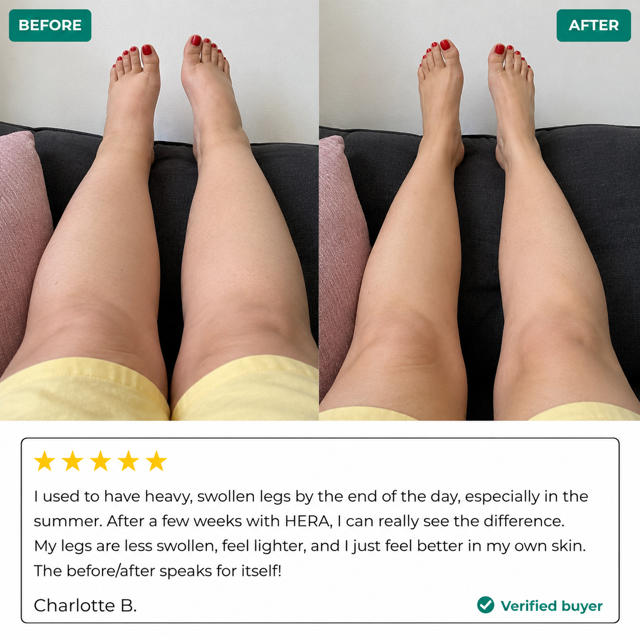 Lymphatic Drainage