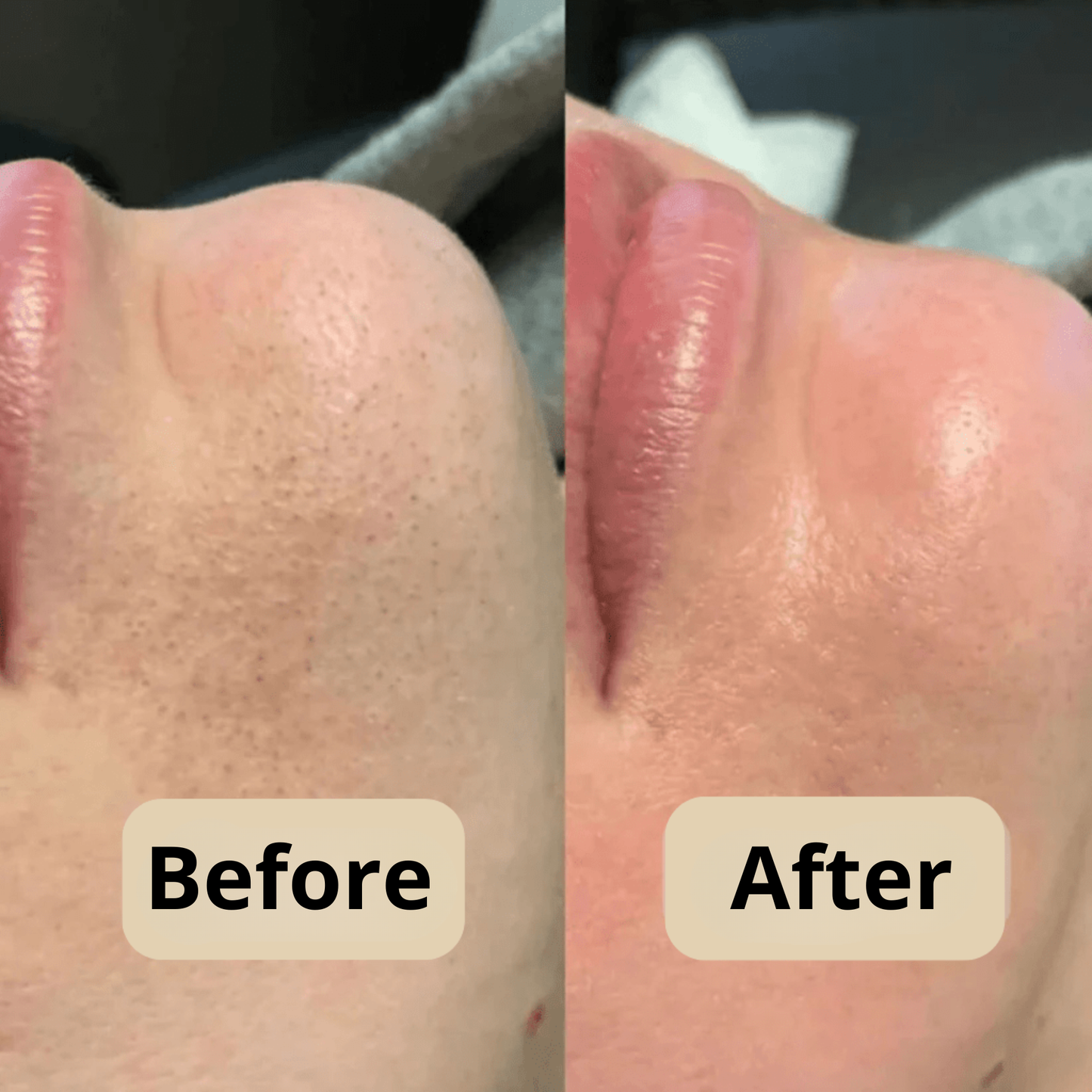 Hera Rice Peel Shot - Clears Pores & Smooths Skin